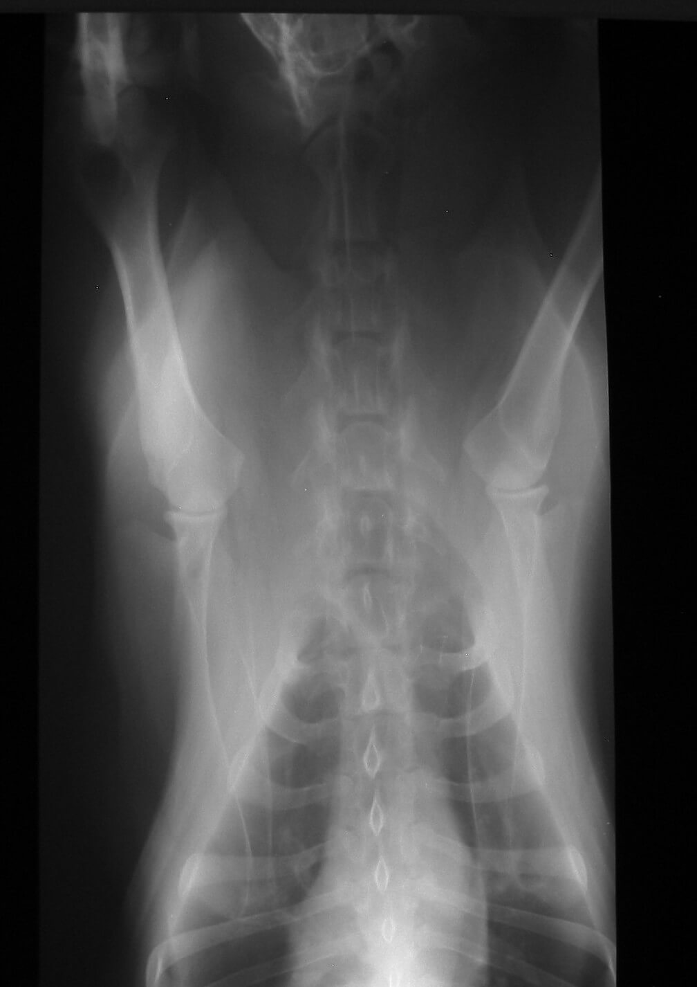 X-ray X-ray